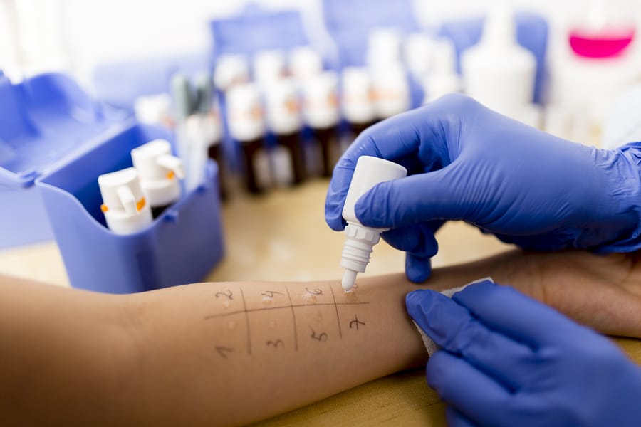 Benefits of Food Allergy Testing
