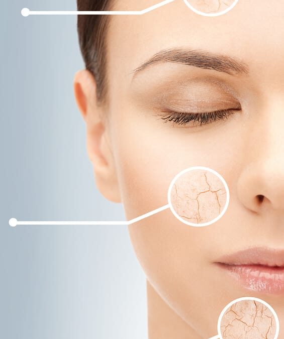 What Is Your Skin Type?
