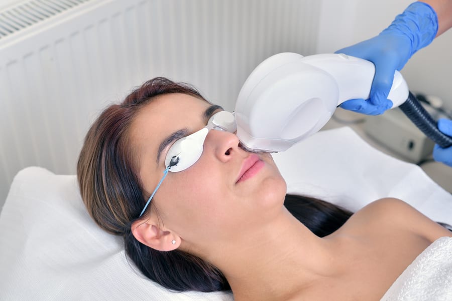 Best Laser Treatment for Removing Age Spots