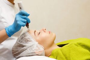 Is MicroNeedling Right for Me