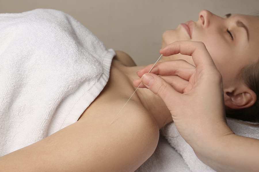 3 Benefits of Acupuncture That You May Not Be Aware Of