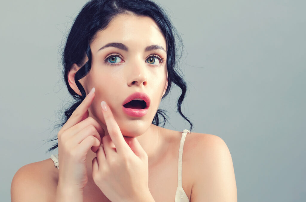 3 Ways to Avoid Summer Acne Breakouts