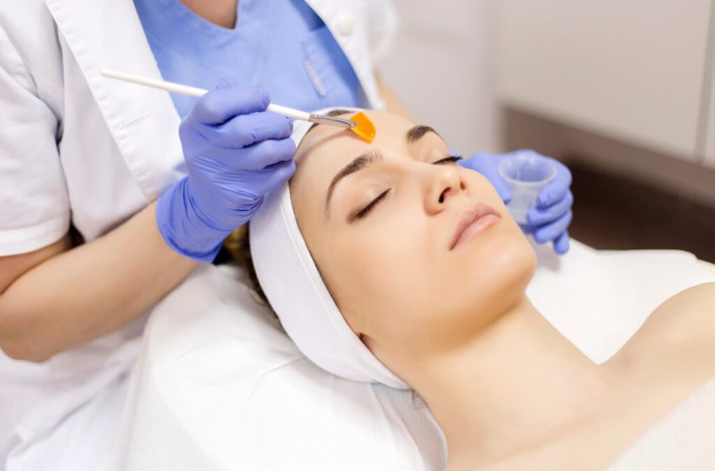 What is a Medical Grade Chemical Peel?