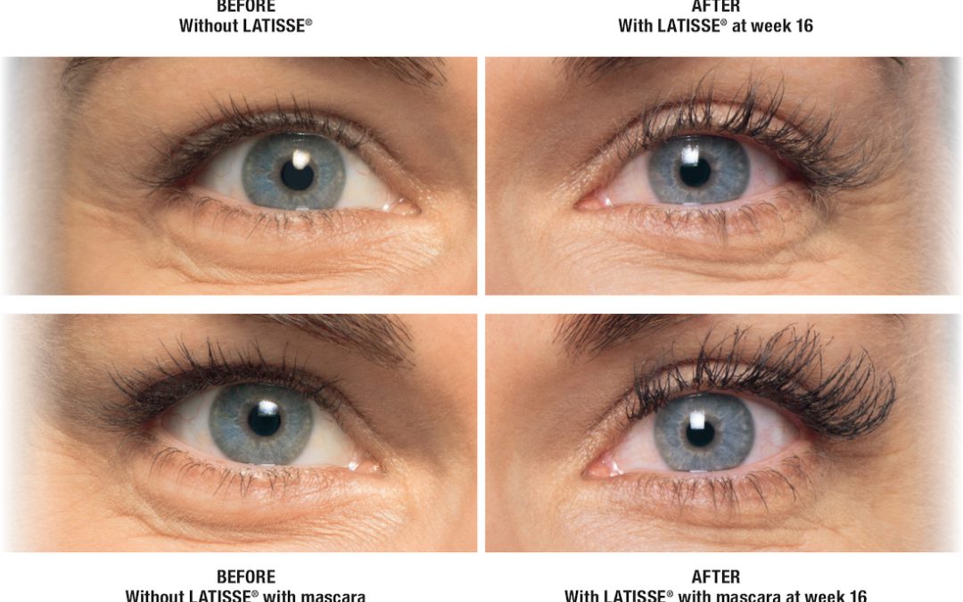 What is a Better Alternative to Lash Extensions?