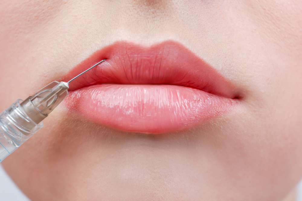 What Can Fillers Do for Me?