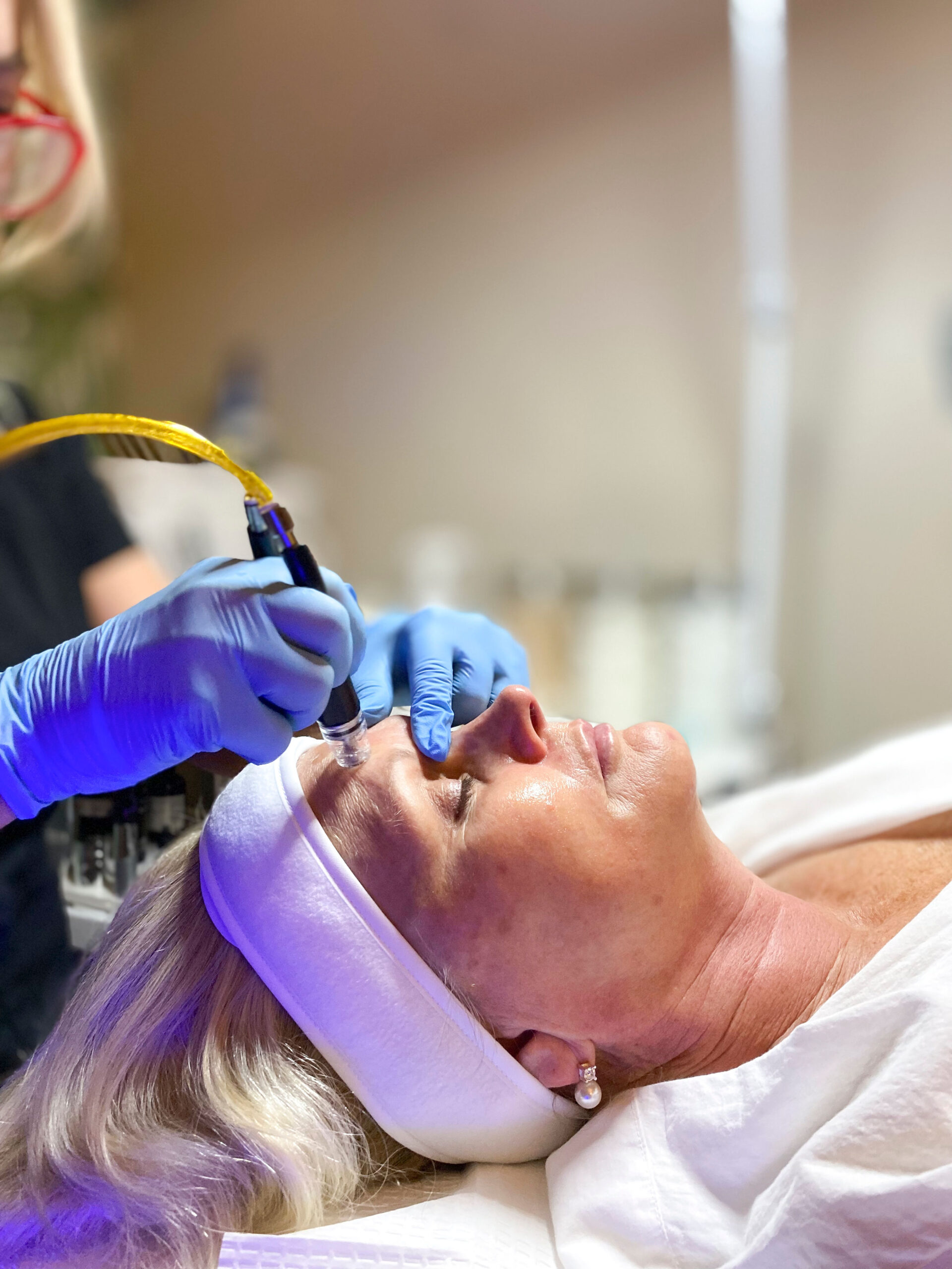 scottsdale-diamondglow-facial-dermaplane