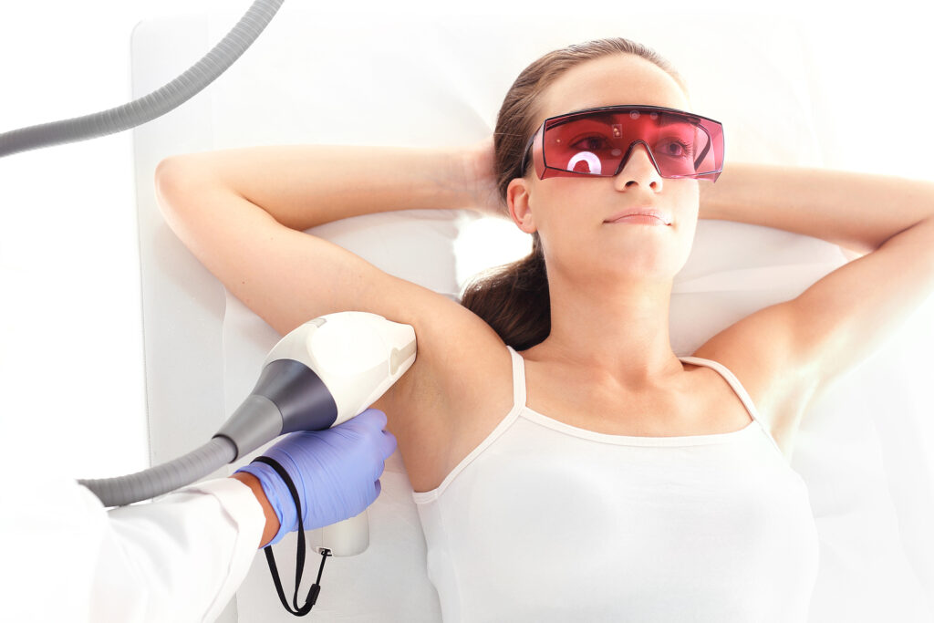 laser-hair-removal