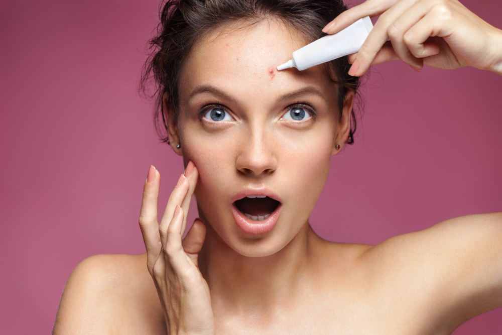 When to Consider Professional Acne Treatments
