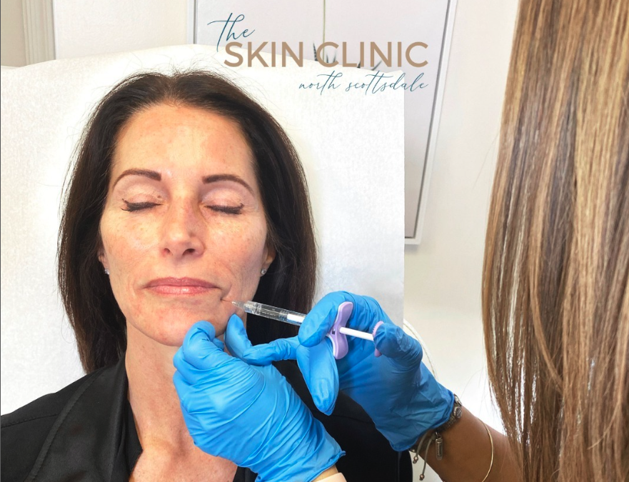 Improve the Look of Your Lower Face With Juvederm Fillers