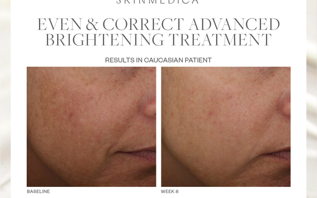 July Featured Product of the Month – Even & Correct Advanced Brightening Treatment