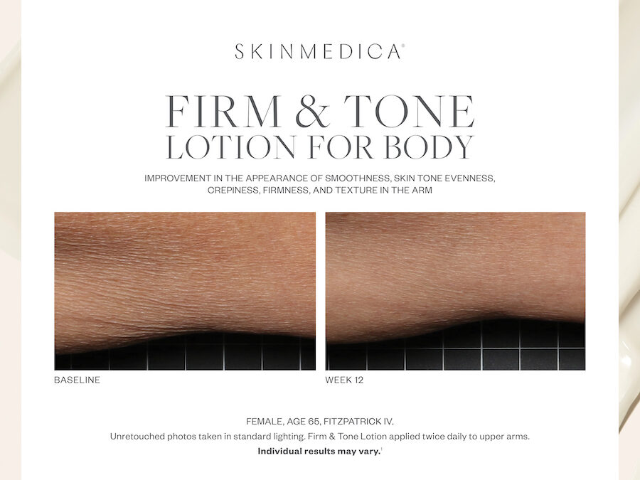 February 2024 Product of the Month – SkinMedica Firm and Tone Lotion