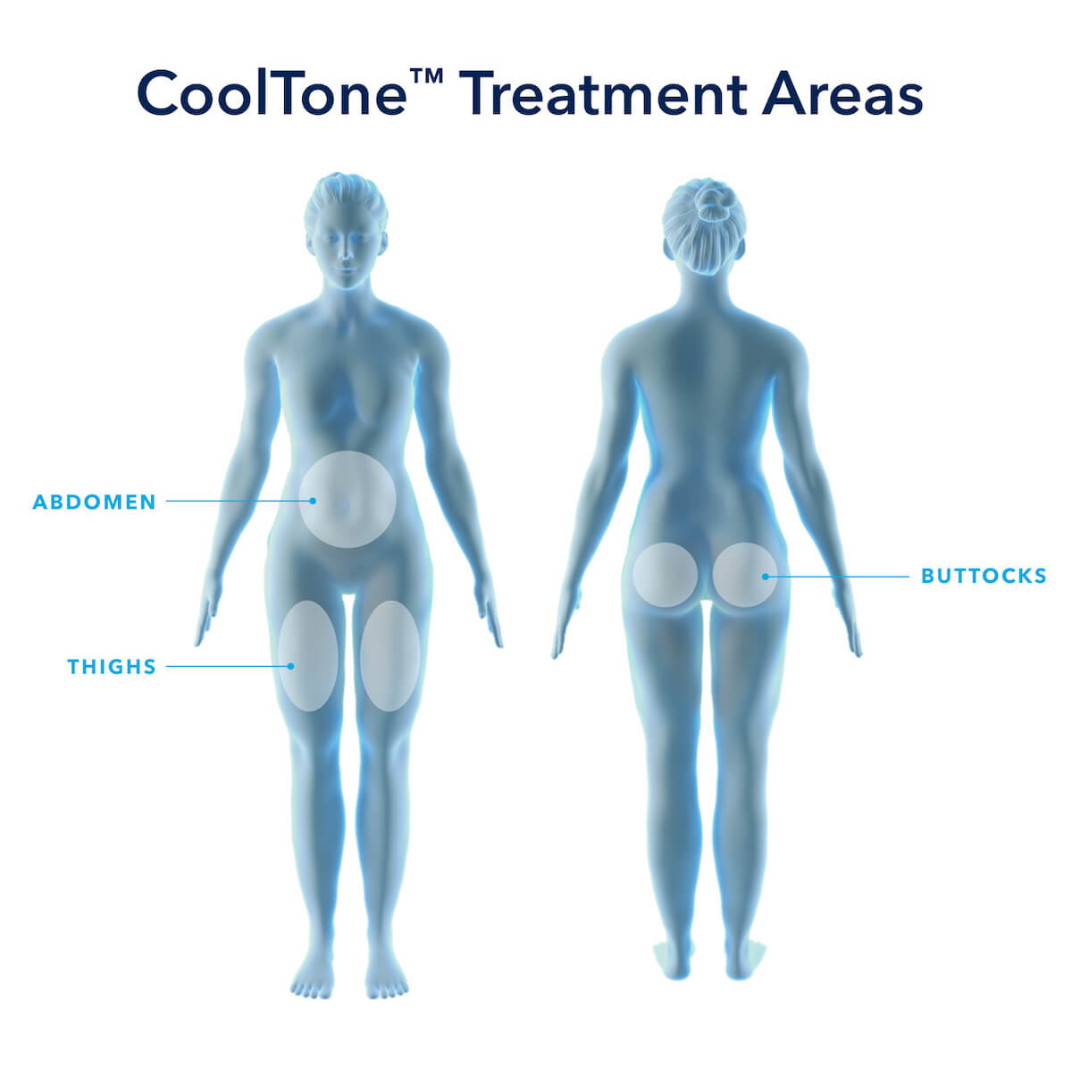 cooltone-treatment-areas