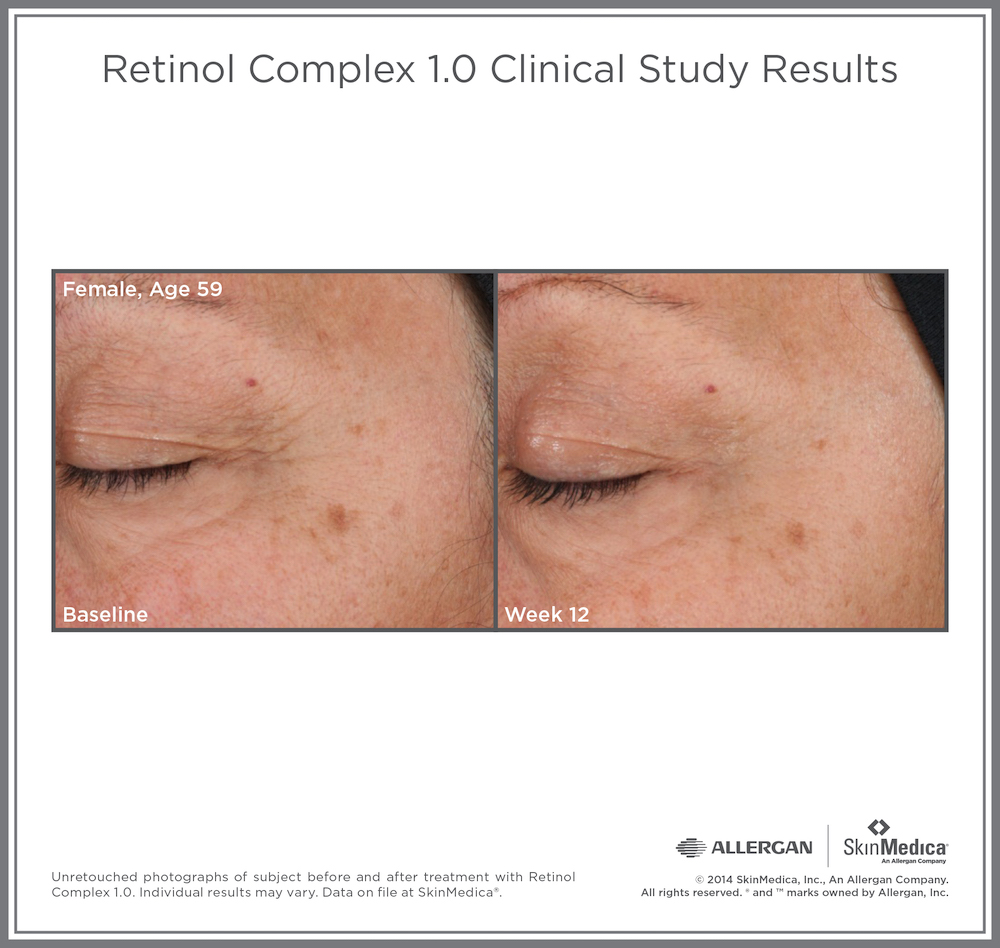 retinol-skincare-skinmedica