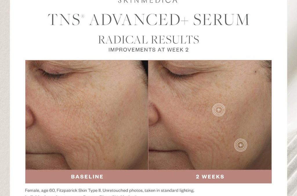 January 2025 Product Of The Month – TNS Advanced+ Serum