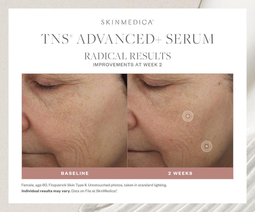 scottsdale-skincare-products-anti-aging