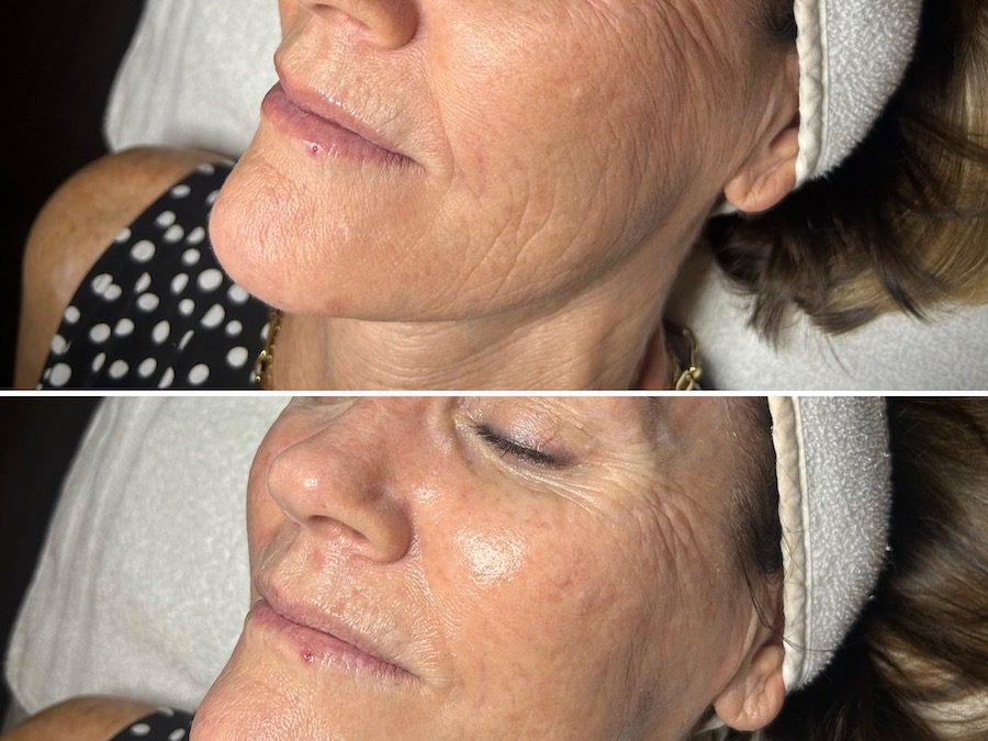 What Is DiamondGlow — And Why Is It One of Scottsdale’s Most Popular Facials?