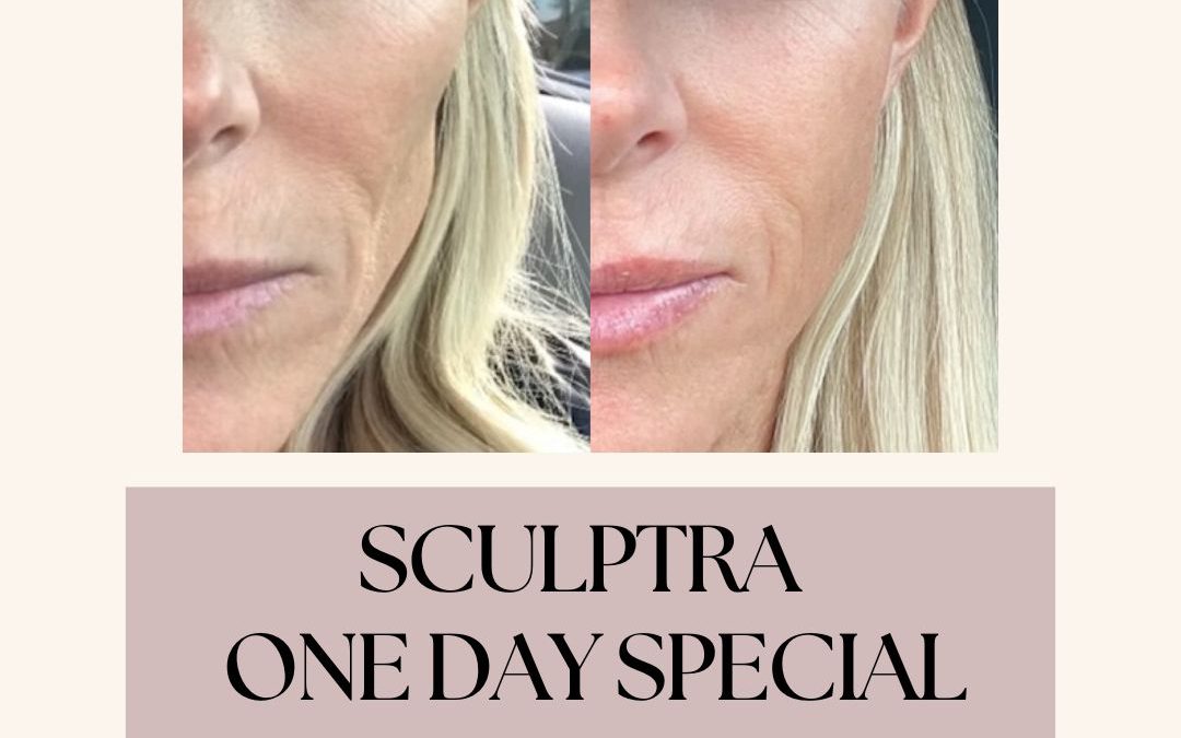 Sculptra One Day Special