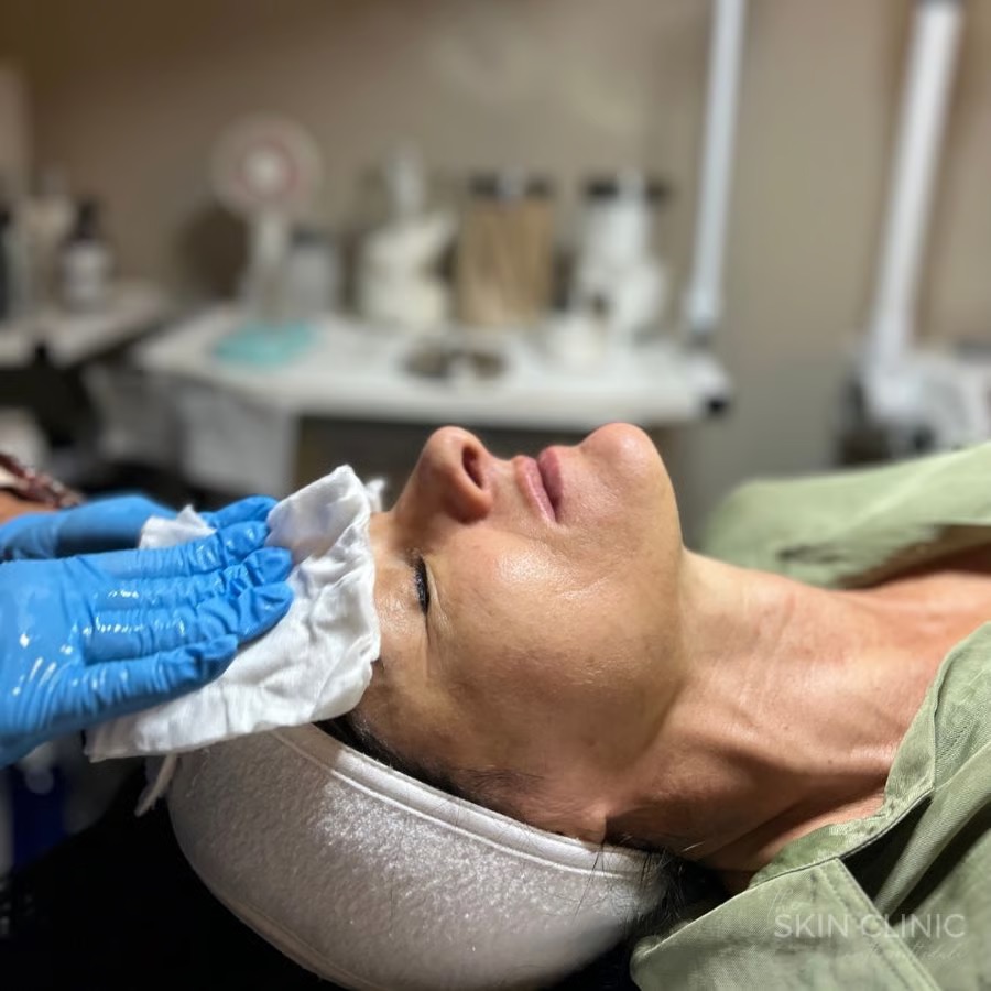 oxytrio-facial-scottsdale-skin-clinic