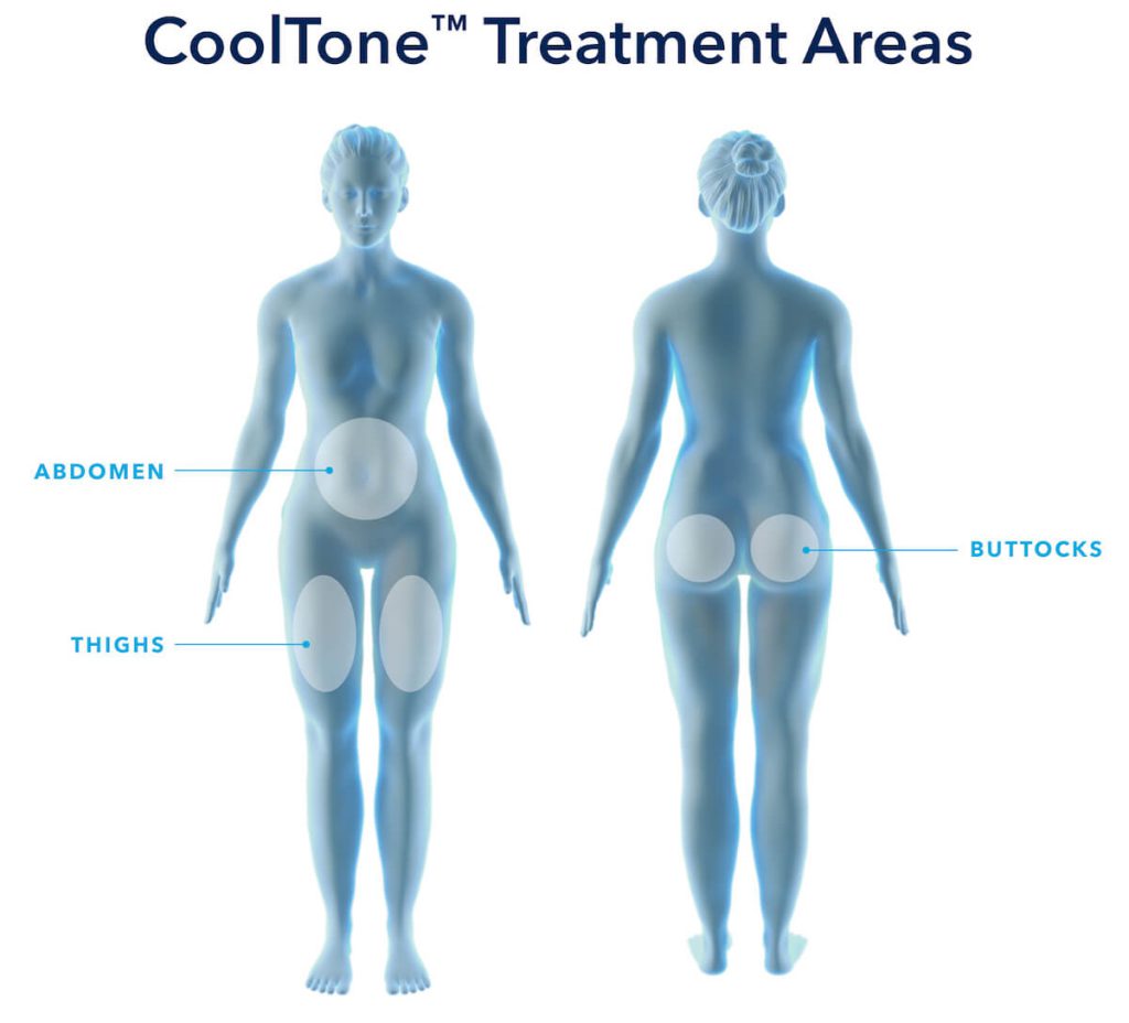 cooltone-treatment-areas