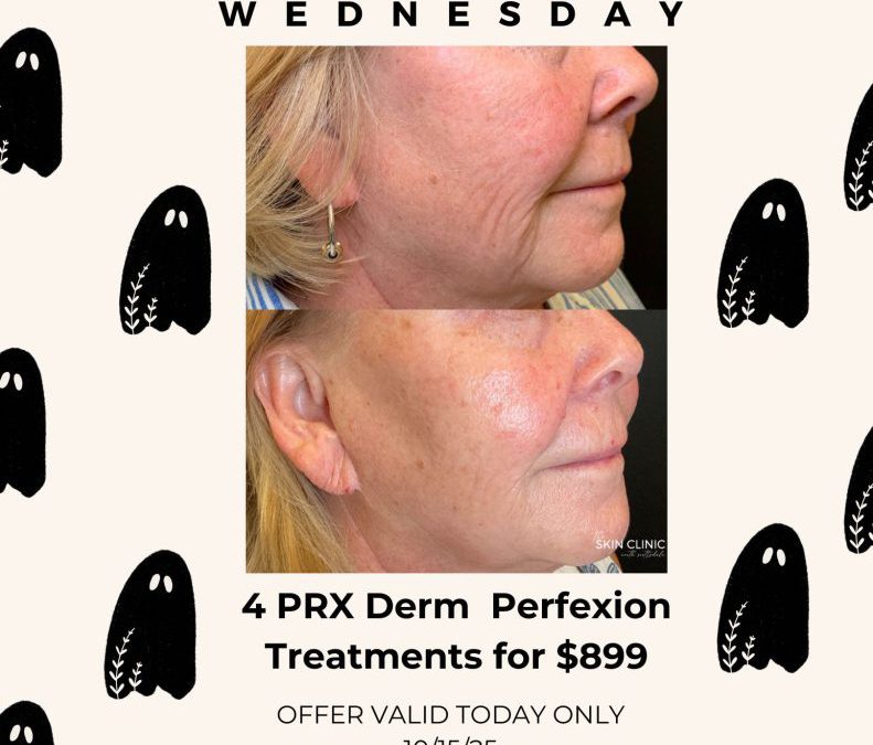Wicked Wednesday PRX Derm Perfexion Special – October 15, 2025