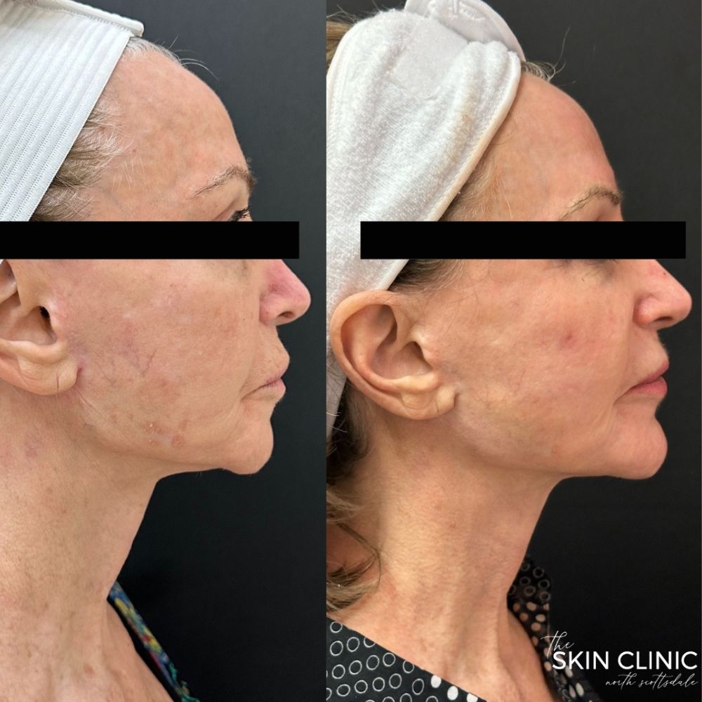 totalfx-treament-scottsdale-az