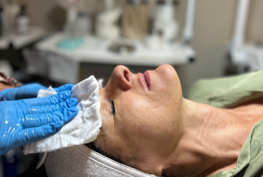 What Actually Happens to Your Skin During a Chemical Peel (And Why That’s a Good Thing)