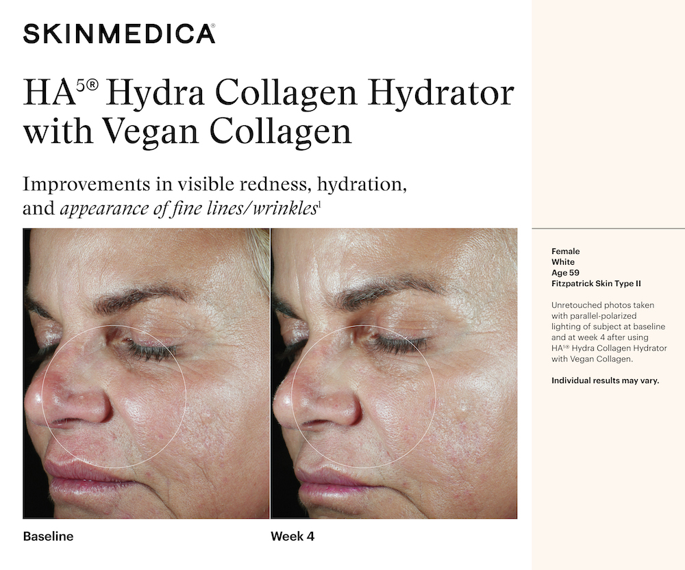SkinMedica HA5 Hydra Collagen Hydrator