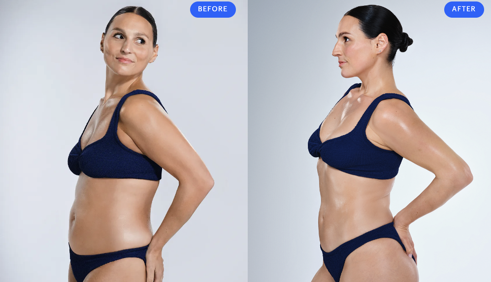 coolsculpting-before-and-after