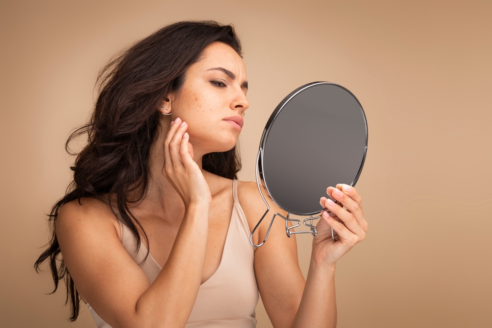 how to treat dark spots from acne